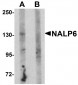 NALP6 Antibody